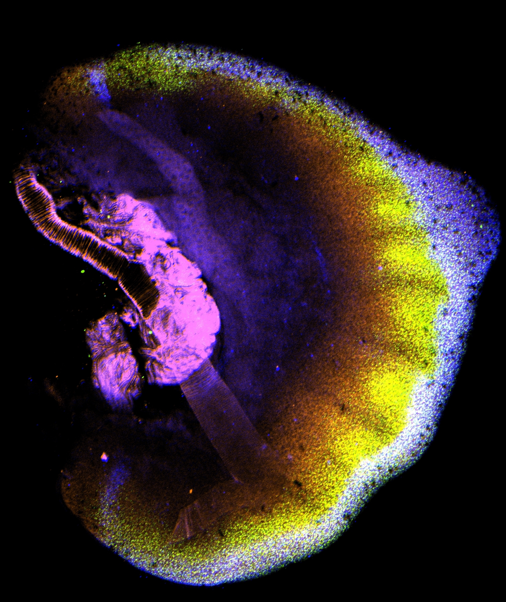 Multiplex FISH 8